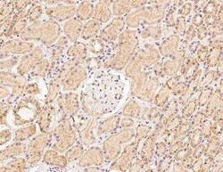 CLN6 Antibody, Novus Biologicals 50 &mu;g | Buy Online | Novus Biologicals | Fisher Scientific