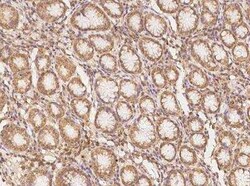 CLN6 Antibody, Novus Biologicals 50 &mu;g | Buy Online | Novus Biologicals | Fisher Scientific