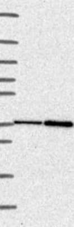CLN6 Rabbit anti-Human, Polyclonal, Novus Biologicals 100 &mu;g | Buy Online | Bio-Techne | Fisher Scientific