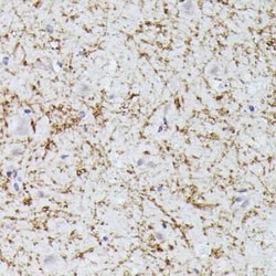 CLN8 Antibody - Azide and BSA Free, Novus Biologicals:Antibodies:Primary