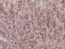 CLPB Antibody, Novus Biologicals:Antibodies:Primary Antibodies
