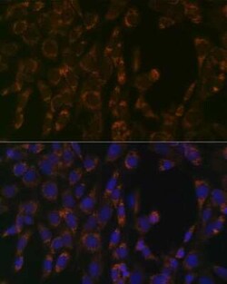 CLPP Rabbit anti-Human, Mouse, Rat, Clone: 1W6O4, Novus Biologicals 20 &mu;g | Buy Online | Novus Biologicals | Fisher Scientific