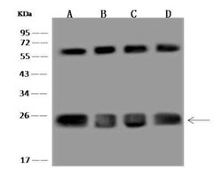 CLPP Antibody, Novus Biologicals 100 &mu;g; Unconjugated:Antibodies, Polyclonal