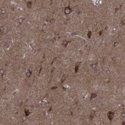 CLPTM1 Rabbit anti-Human, Polyclonal, Novus Biologicals:Antibodies:Primary