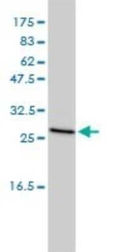 CLTB Antibody (4B12-1E3), Novus Biologicals 0.1 mg | Buy Online | Novus Biologicals | Fisher Scientific