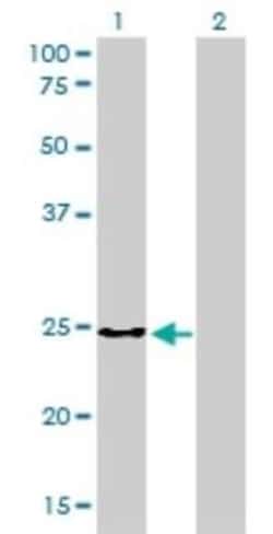 CLTB Antibody (4B12-1E3), Novus Biologicals 0.1 mg | Buy Online | Novus Biologicals | Fisher Scientific