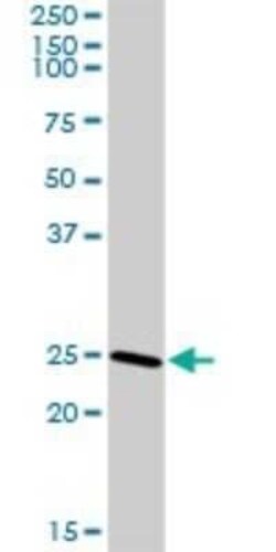 CLTB Antibody, Novus Biologicals 0.1 mg | Buy Online | Novus Biologicals | Fisher Scientific