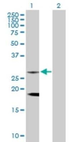 CLTB Antibody, Novus Biologicals 0.1 mg | Buy Online | Novus Biologicals | Fisher Scientific