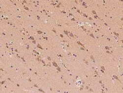 CLVS2 Antibody, Novus Biologicals 100 &mu;g, Unconjugated:Antibodies, Polyclonal