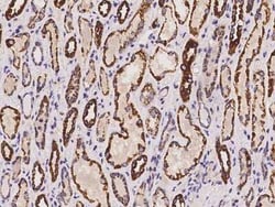 CLYBL Antibody, Novus Biologicals 100 &mu;g, Unconjugated:Antibodies, Polyclonal