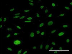 CMAS Antibody (2E1), Novus Biologicals 0.1 mg | Buy Online | Novus Biologicals | Fisher Scientific