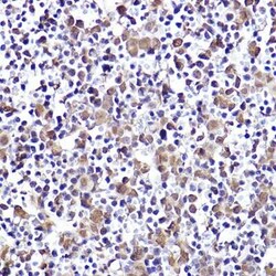 CMIP Rabbit anti-Human, Mouse, Rat, Polyclonal, Novus Biologicals:Antibodies:Primary