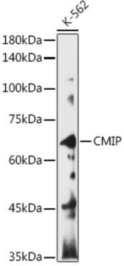 CMIP Rabbit anti-Human, Mouse, Rat, Polyclonal, Novus Biologicals:Antibodies:Primary