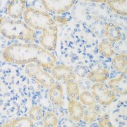 CML2 Antibody - BSA Free, Novus Biologicals 0.1 mL, Unconjugated:Antibodies,