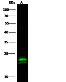 CMP kinase Antibody (08), Novus Biologicals:Antibodies:Primary Antibodies