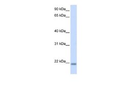CNBP Antibody, Novus Biologicals 100 &mu;L | Buy Online | Novus Biologicals | Fisher Scientific