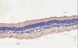 CNGB3 Antibody, Novus Biologicals 100 &mu;g | Buy Online | Novus Biologicals | Fisher Scientific