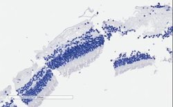 CNGB3 Antibody, Novus Biologicals 100 &mu;g | Buy Online | Novus Biologicals | Fisher Scientific