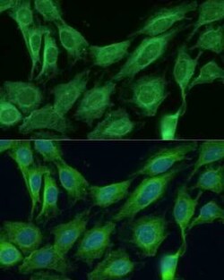 CNNM1 Rabbit anti-Human, Mouse, Rat, Polyclonal, Novus Biologicals:Antibodies:Primary