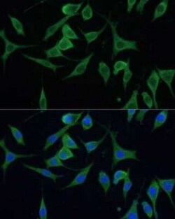 CNNM1 Rabbit anti-Human, Mouse, Rat, Polyclonal, Novus Biologicals:Antibodies:Primary