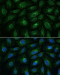 CNNM1 Rabbit anti-Human, Mouse, Rat, Polyclonal, Novus Biologicals:Antibodies:Primary