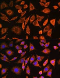 CNOT1 Antibody - Azide and BSA Free, Novus Biologicals:Antibodies:Primary