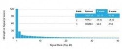 CNOT10 Mouse anti-Human, Clone: PCRP-CNOT10-1D5, Novus Biologicals 100
