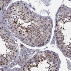 CNOT11 Rabbit anti-Human, Polyclonal, Novus Biologicals:Antibodies:Primary