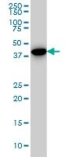 CNOT2 Antibody (3F1), Novus Biologicals 0.05 mg | Buy Online | Novus Biologicals | Fisher Scientific