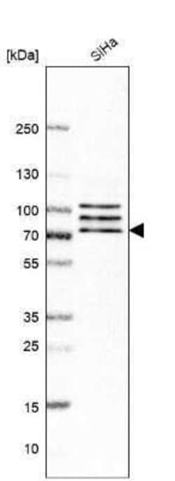 CNOT4 Antibody, Novus Biologicals 25 &mu;L; Unconjugated:Antibodies, Polyclonal