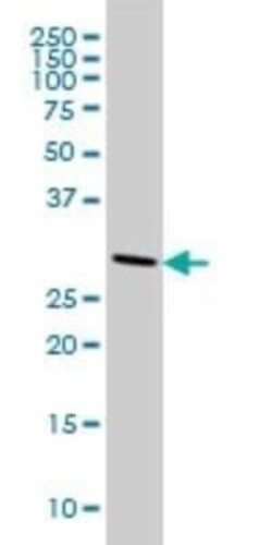 CNOT7 Antibody (2F6), Novus Biologicals 0.1 mg | Buy Online | Novus Biologicals | Fisher Scientific