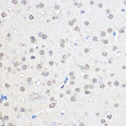 CNOT7 Antibody - Azide and BSA Free, Novus Biologicals 0.02 mL, Unconjugated:Antibodies,