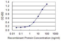 CNOT8 Antibody (1F11), Novus Biologicals 0.1 mg | Buy Online | Novus Biologicals | Fisher Scientific