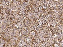 CNPY2 Antibody, Novus Biologicals 50 &mu;g; Unconjugated:Antibodies, Polyclonal