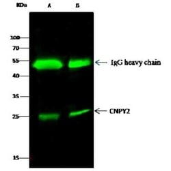 CNPY2 Antibody, Novus Biologicals 50 &mu;g; Unconjugated:Antibodies, Polyclonal