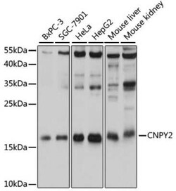CNPY2 Antibody - Azide and BSA Free, Novus Biologicals 0.02 mL, Unconjugated:Antibodies,