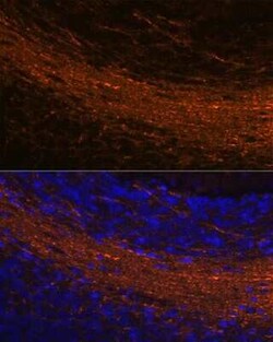 CNPase Rabbit anti-Human, Mouse, Rat, Clone: 8O3B6, Novus Biologicals 20 &mu;g | Buy Online | Novus Biologicals | Fisher Scientific