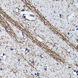 CNPase Rabbit anti-Human, Mouse, Rat, Clone: 8O3B6, Novus Biologicals 20 &mu;g | Buy Online | Novus Biologicals | Fisher Scientific