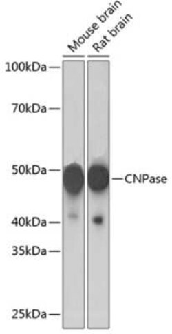 CNPase Rabbit anti-Human, Mouse, Rat, Clone: 8O3B6, Novus Biologicals 20 &mu;g | Buy Online | Novus Biologicals | Fisher Scientific