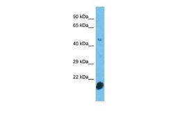 CNTD2 Rabbit anti-Human, Polyclonal, Novus Biologicals 0.1ml; Unconjugated:Antibodies,