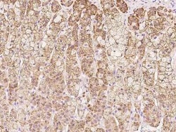 COA5 Antibody, Novus Biologicals:Antibodies:Primary Antibodies