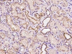 COA5 Antibody, Novus Biologicals:Antibodies:Primary Antibodies