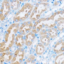 COG1 Rabbit anti-Human, Mouse, Rat, Polyclonal, Novus Biologicals 20 &mu;g;