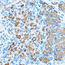 COG1 Rabbit anti-Human, Mouse, Rat, Polyclonal, Novus Biologicals 20 &mu;g;