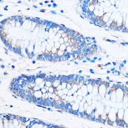 COG1 Rabbit anti-Human, Mouse, Rat, Polyclonal, Novus Biologicals 20 &mu;g;