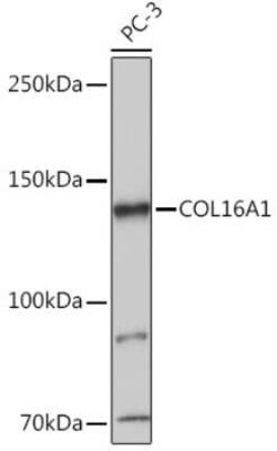 COL16A1 Rabbit anti-Human, Mouse, Rat, Polyclonal, Novus Biologicals 20 &mu;g | Buy Online | Novus Biologicals | Fisher Scientific