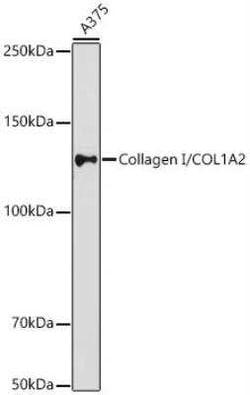 COL1A2 Antibody - Azide and BSA Free, Novus Biologicals 0.1 mL, Unconjugated:Antibodies,