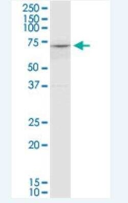 COL8A2 Antibody (1F4), Novus Biologicals 100 &mu;g | Buy Online | Novus Biologicals | Fisher Scientific