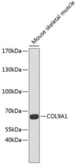 COL9A1 Antibody - BSA Free, Novus Biologicals:Antibodies:Primary Antibodies