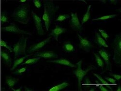 COMMD1 Antibody (2B12), Novus Biologicals 0.1 mg | Buy Online | Novus Biologicals | Fisher Scientific